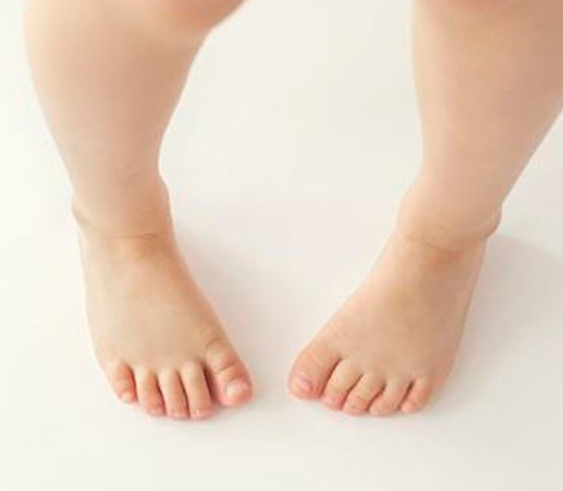 alteraciones-marcha-2