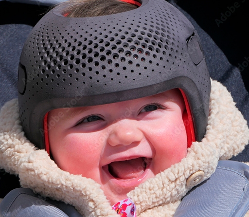 braquicefalia-que-es